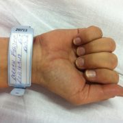rfid wristband hospital
